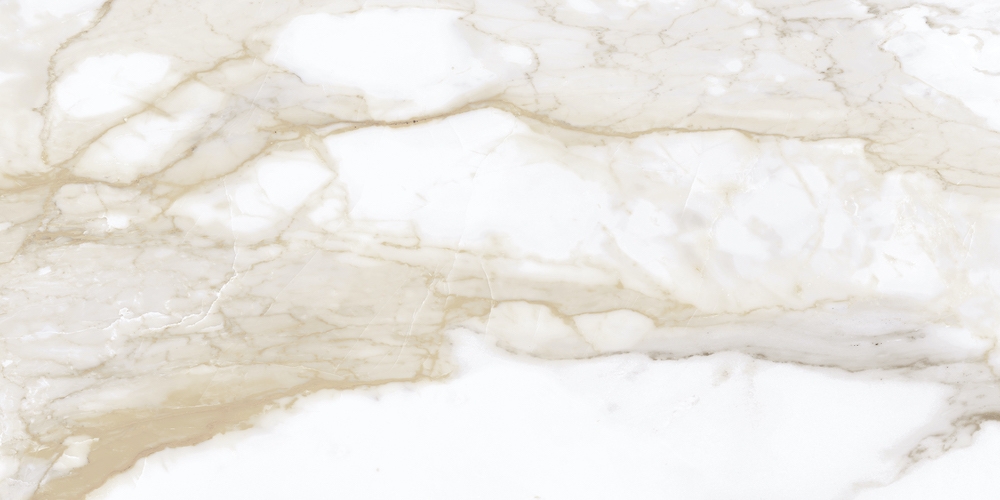 Revestimientos Dalgres XL